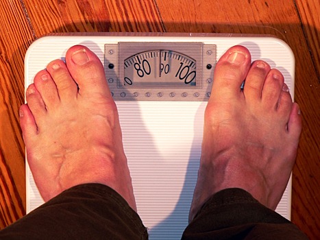 Эксперт: в России чаще диагностируют ожирение благодаря большей настороженности врачей
