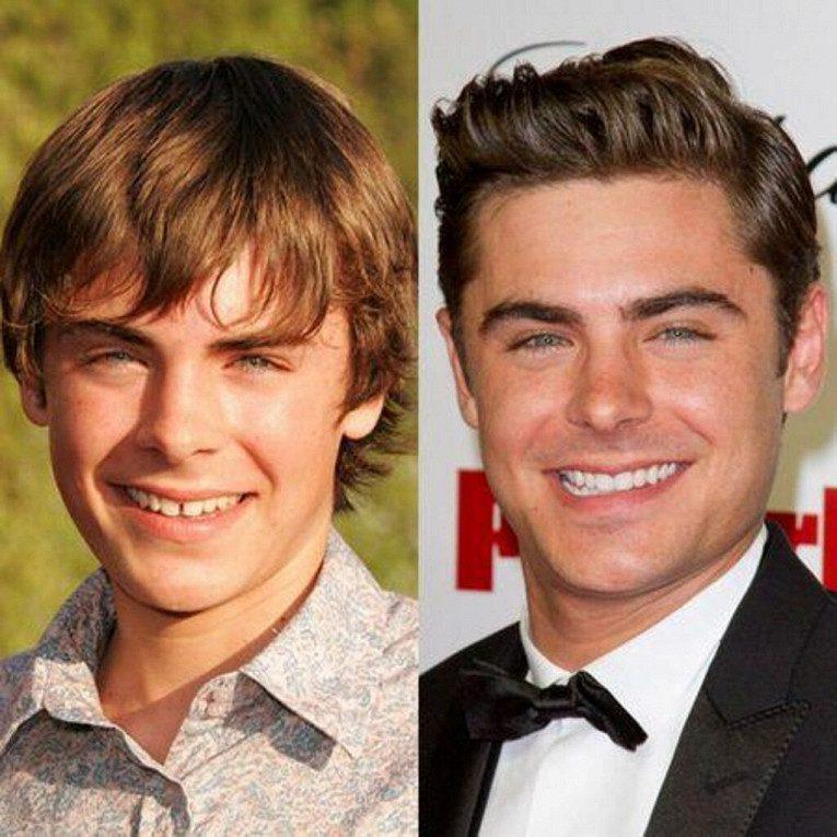 Как плохие зубы звезд превратились в улыбки на миллион: фото до и после4