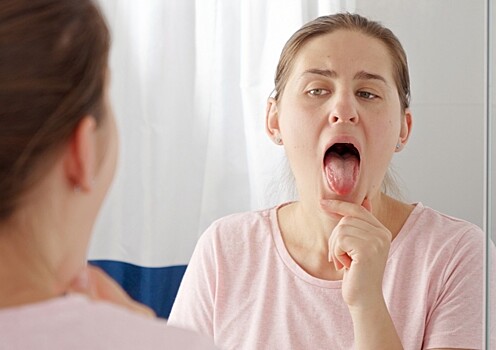 Терапевт объяснила, какой налет на языке говорит о больных желудке и печени