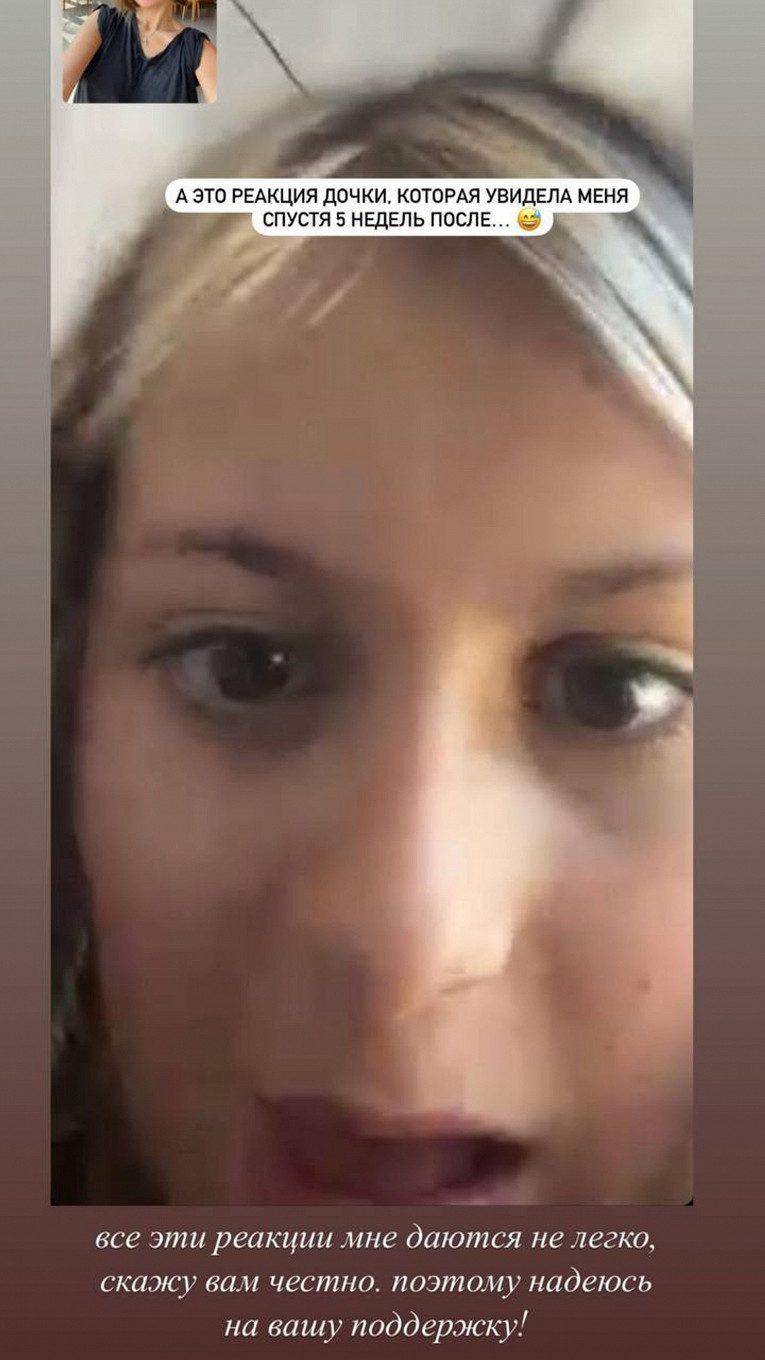 Виктория Боня показала реакцию дочери на ее лицо после операции1