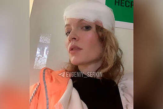 Актриса Стебунова упала со сцены в театре и повредила челюсть