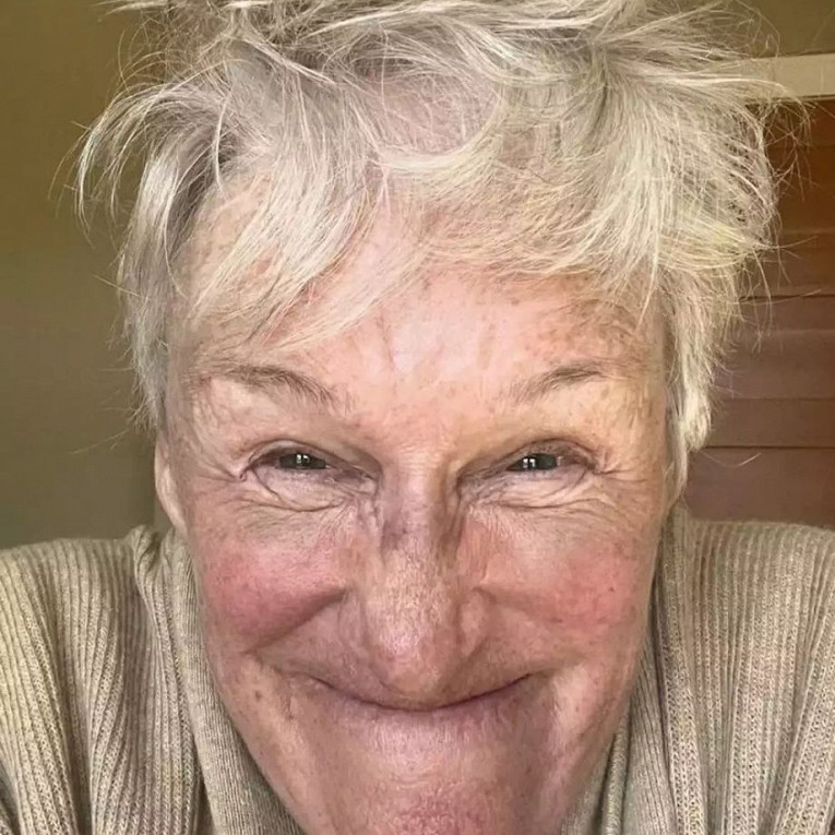 77-летняя звезда «101 далматинца» Гленн Клоуз насмешила поклонников фото без макияжа1