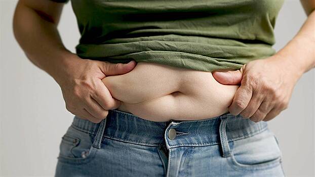 Эндокринолог перечислила признаки лишнего веса