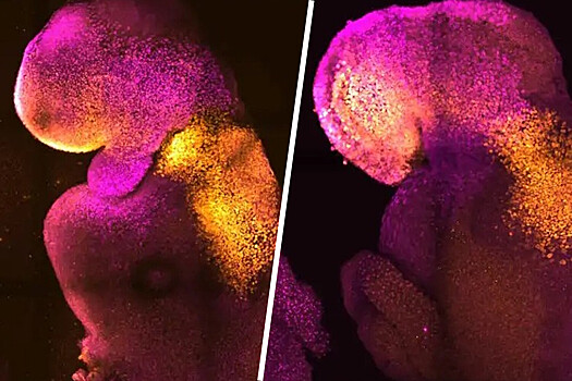 Ученые впервые вырастили живую модель нервной системы эмбриона человека