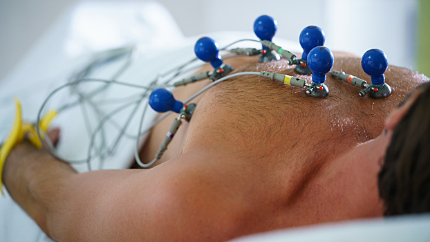 В России создали нейросеть-кардиолога, умеющую находить заболевания по ЭКГ