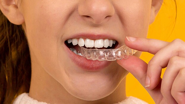 Имплантолог рассказал, как можно восстановить травмированный зуб