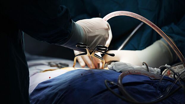 В Херсонской области хирурги извлекли из желудка мужчины 26 монет