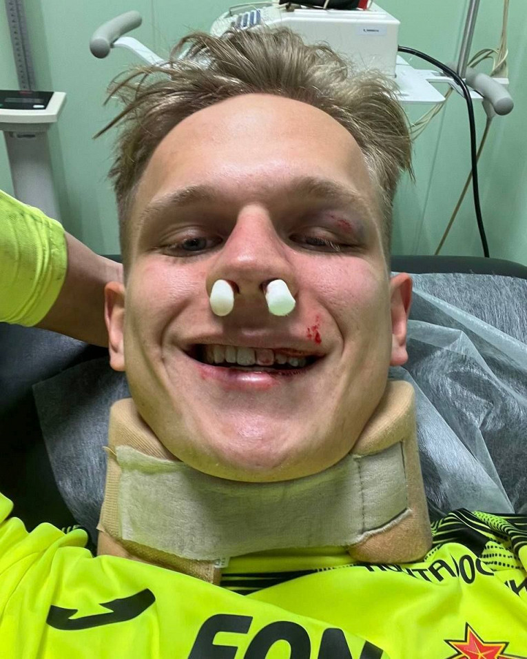 ЦСКА опубликовал фото Торопа из больницы после тяжёлой травмы в матче с «Зенитом»1