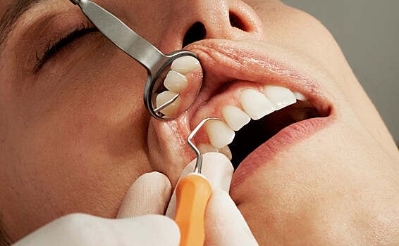 Дырки в зубах: почему появляются и как лечить