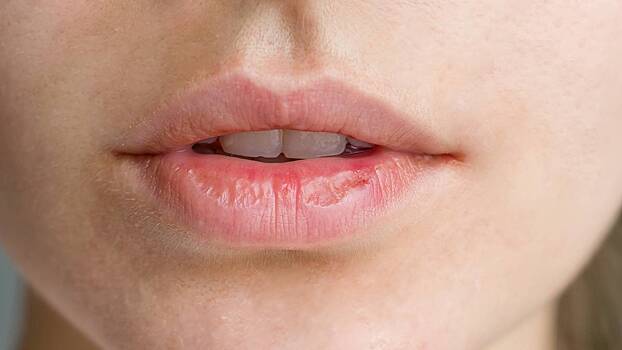 Онколог рассказал о причинах развития рака губ
