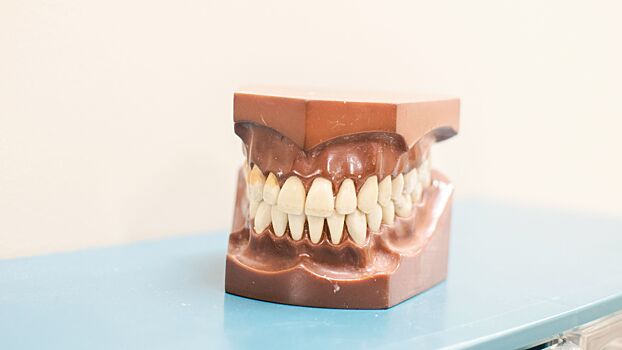 Как избавиться от застрявших в зубах остатков шашлыка