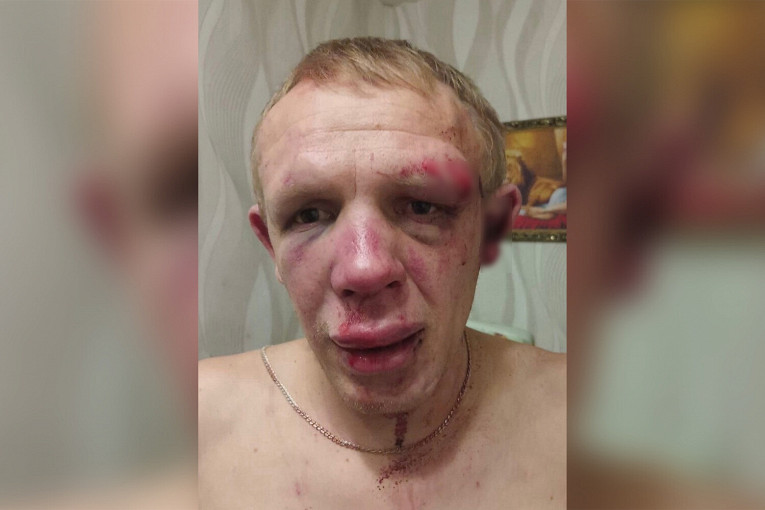 В Белгороде группа неизвестных избила приехавшего на отдых участника СВО1