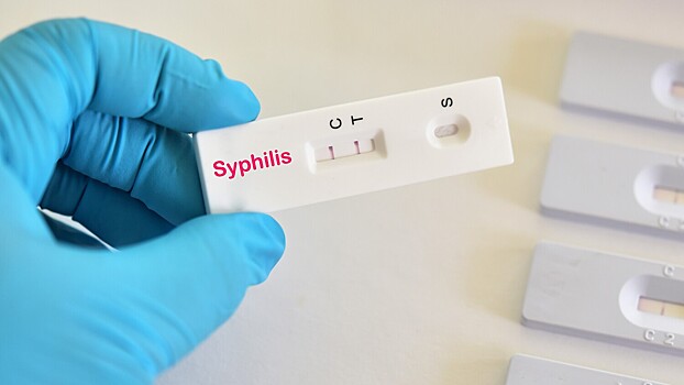 Врач заявил, что поздние стадии сифилиса стали чаще встречаться из-за COVID-19