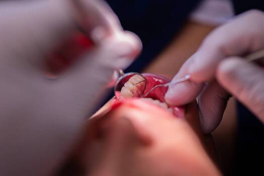 Протекают бессимптомно: стоматолог назвал опасные болезни полости рта