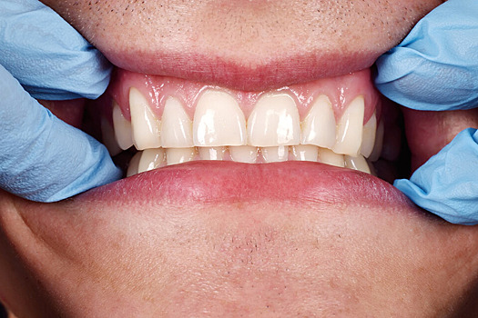 Стоматолог рассказал, как работа ЖКТ отражается на здоровье зубов