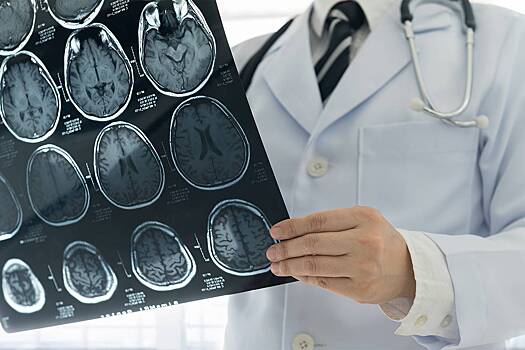 Ученому из Канады запретили исследовать загадочную болезнь мозга