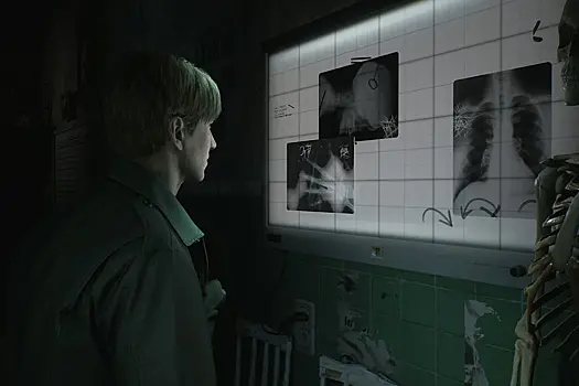 Сборы на русскую локализацию ремейка Silent Hill 2 от GamesVoice успешно завершены